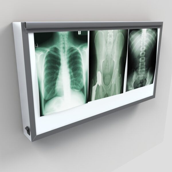 X-RAY View Box GYR-547